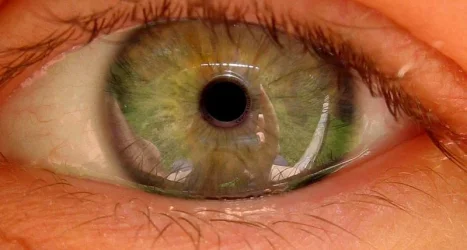aneye.webp