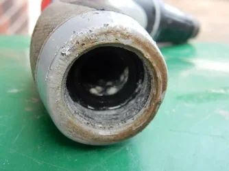 calcium deposit.webp