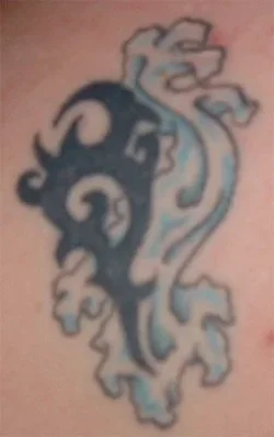 shoulder.webp