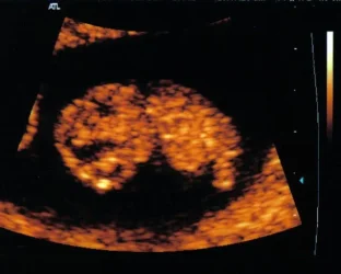 baby2.webp