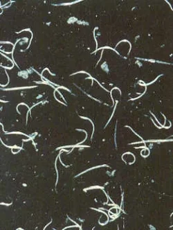 nematodes.webp