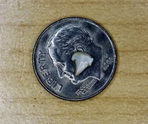 12345678911tooth.webp