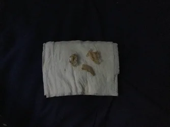 image.webp