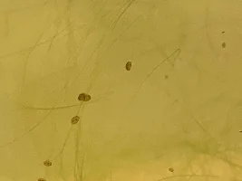 Copepods in my aquarium
