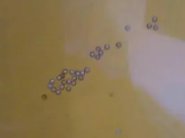 Fish Eggs!