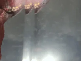 Betta with Tuberculosis?