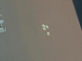 White dots on dead mystery snail and fish tank wall??? Please help!