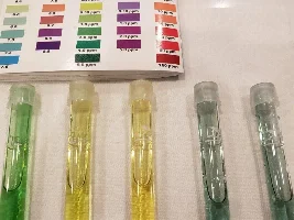 Fluval Stratum raises ammonia level?