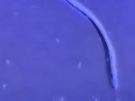 Worms attached to glass