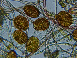 Life after dinoflagellates