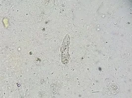 Need help with microscopic identification