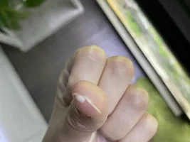 My guppy fry had this in its mouth? What it is?