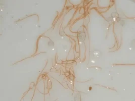 @colin, and anyone else, help please! Worms found in tank...