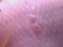 Infected Fish! Please Help!