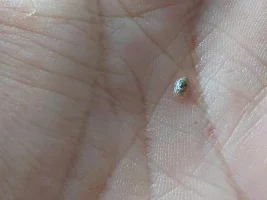 Found these on the glass of both my aquariums - action/no action needed?