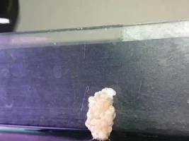 Are These Snail Eggs?