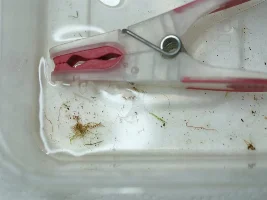 @colin, and anyone else, help please! Worms found in tank...