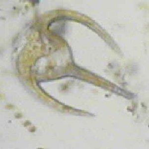 cyanobactria2.jpg