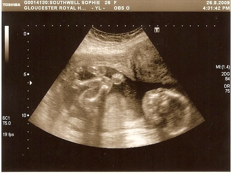 scan0008.jpg