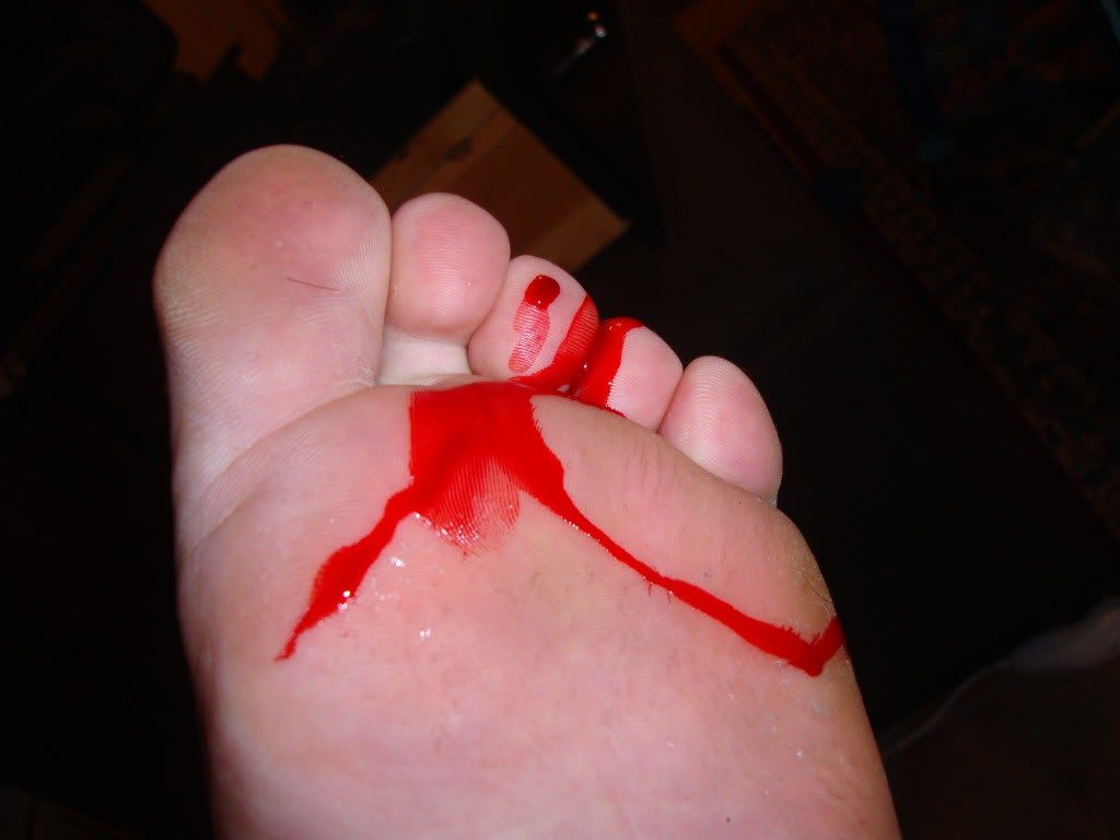 04Bloodyfoot.jpg