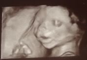 3DultrasoundofDylan20weeks.jpg