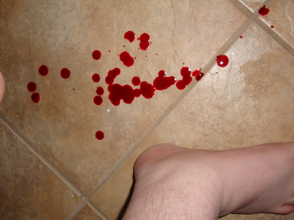 02BloodyFloor.jpg